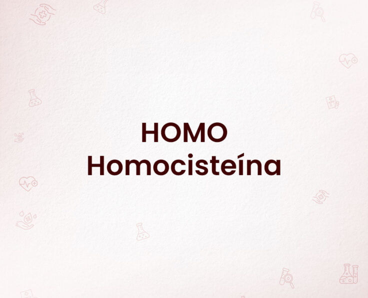 HOMO---Homocisteína